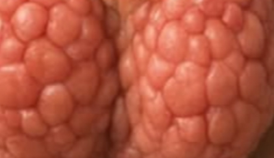 6 Simple Steps to Support Thyroid Health Naturally