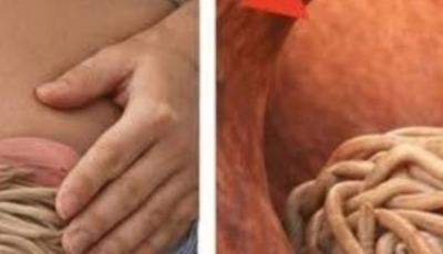 Garlic eliminates parasites in just 1 day? What you really should know before trying it
