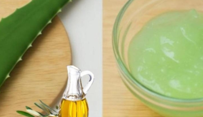 Aloe Vera for Varicose Veins and Tired Legs: Natural Relief You Can Try at Home