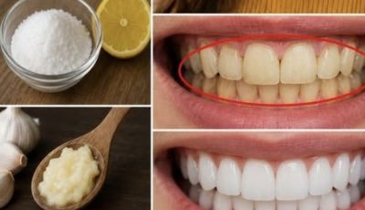 How to Whiten Teeth Naturally at Home: Easy Remedies and Daily Habits for a Brighter Smile